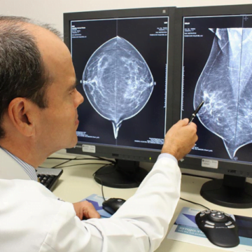 Capivari de Baixo zera fila de mamografias no Mês das Mulheres