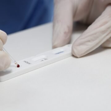 Em meio ao aumento de casos, Imbituba compra testes para a detecção da influenza