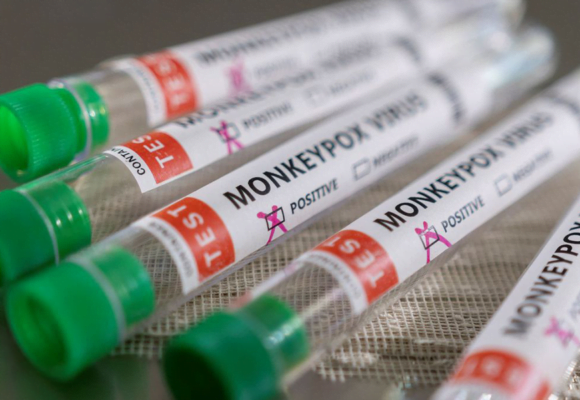 Santa Catarina anuncia plano de contingência de prevenção à varíola dos macacos