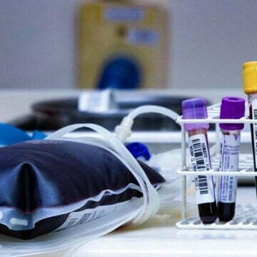 Hemosc tem crescimento de 3,4% no volume de doações de sangue em 2022 Hemosc tem crescimento de 3,4% no volume de doações de sangue em 2022