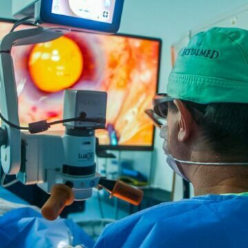 Hospital do Sul de SC atende 348 pacientes que aguardavam cirurgia de catarata Hospital do Sul de SC atende 348 pacientes que aguardavam cirurgia de catarata