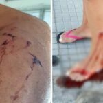 Justiça determina que Prefeitura de Laguna adote medidas após ataques de animais de rua