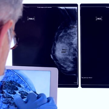 Outubro Rosa: campanha alerta sobre prevenção e diagnóstico precoce