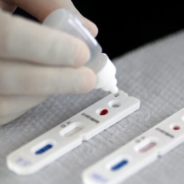 Número de casos de Covid aumenta 490% em um mês em Gravatal