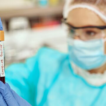 Covid-19: Tubarão tem aumento no número de casos Covid-19: Tubarão tem aumento no número de casos