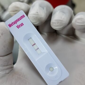 Metapneumovírus: entenda o vírus respiratório que preocupa especialistas