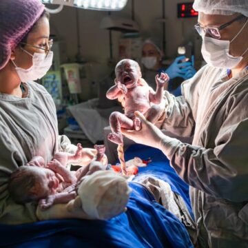 Gestante dá à luz a trigêmeas após ser mãe de gêmeos, em Tubarão