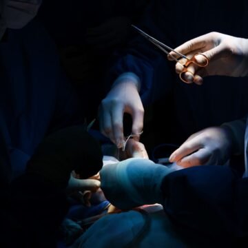 Santa Catarina segue batendo recordes de cirurgias e ultrapassa a marca de 900 mil procedimentos